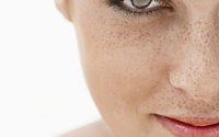 Best Skin Pigmentation Treatment - Dermatologistmumbai.com.jpg